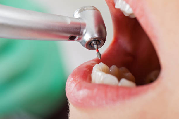 Best Cosmetic Emergency Dentistry in Vail, CO